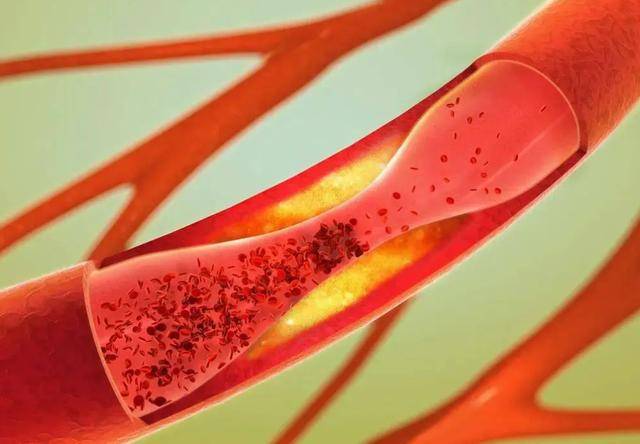 劝告:这4种肉,建议少吃或不吃_疾病_身体_癌症