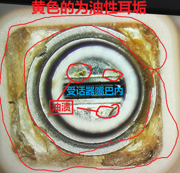 冬天这样做,助听器多用好几年--万聪听力连锁店_受话器_电池_用户