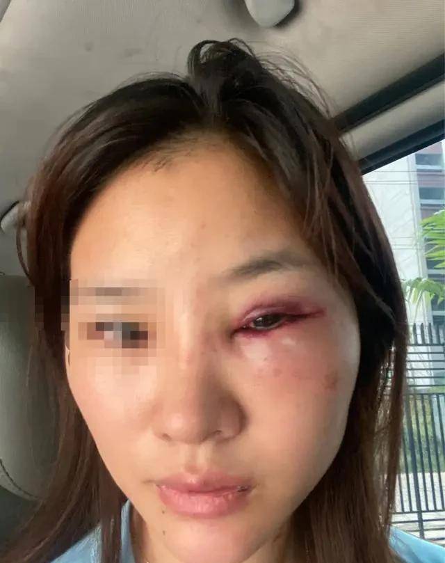 福建女子在柬埔寨,被老乡暴力侵犯数次,报警后反遭威
