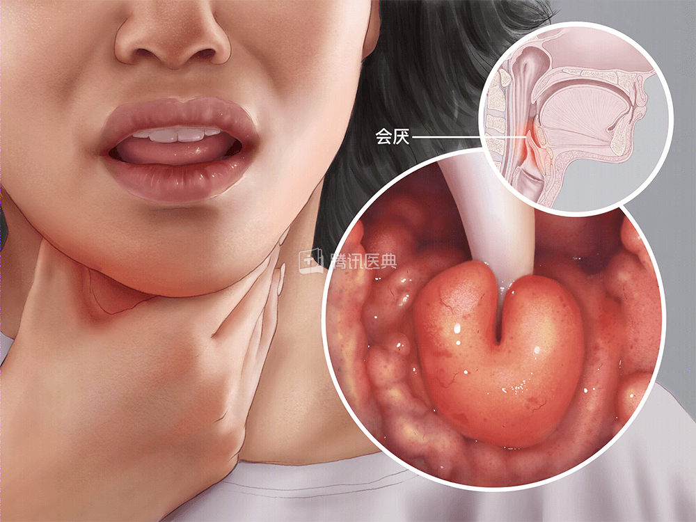 女性喉咙掐住图片