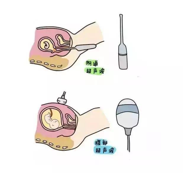 脂肪,肌肉,肠道或膀胱,会受到阻挡,能传递到子宫,卵巢,输卵管或子宫颈