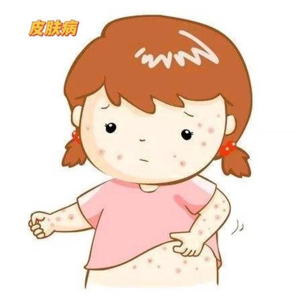 预防春季常见皮肤病 听听医生怎样说_进行_发病_患者