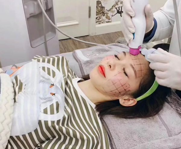 做热玛吉有什么效果和副作用)热玛吉做完以后的效果热玛吉美容的原理