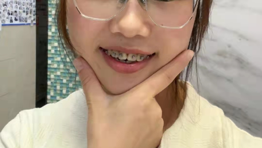 口腔_问题_牙刷