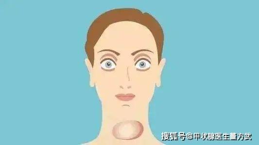 怎么知道自己是否患有甲亢?可以从这几种症状来判断!