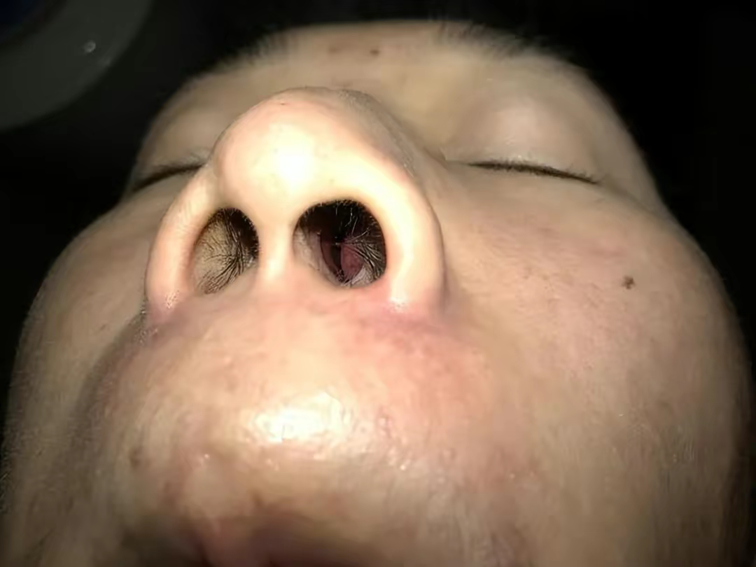 鼻子_效果_感觉