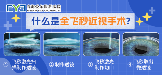 术前需要进行眼睑,眼底和泪道等常规检查,还有散瞳验光,眼压,角膜地形