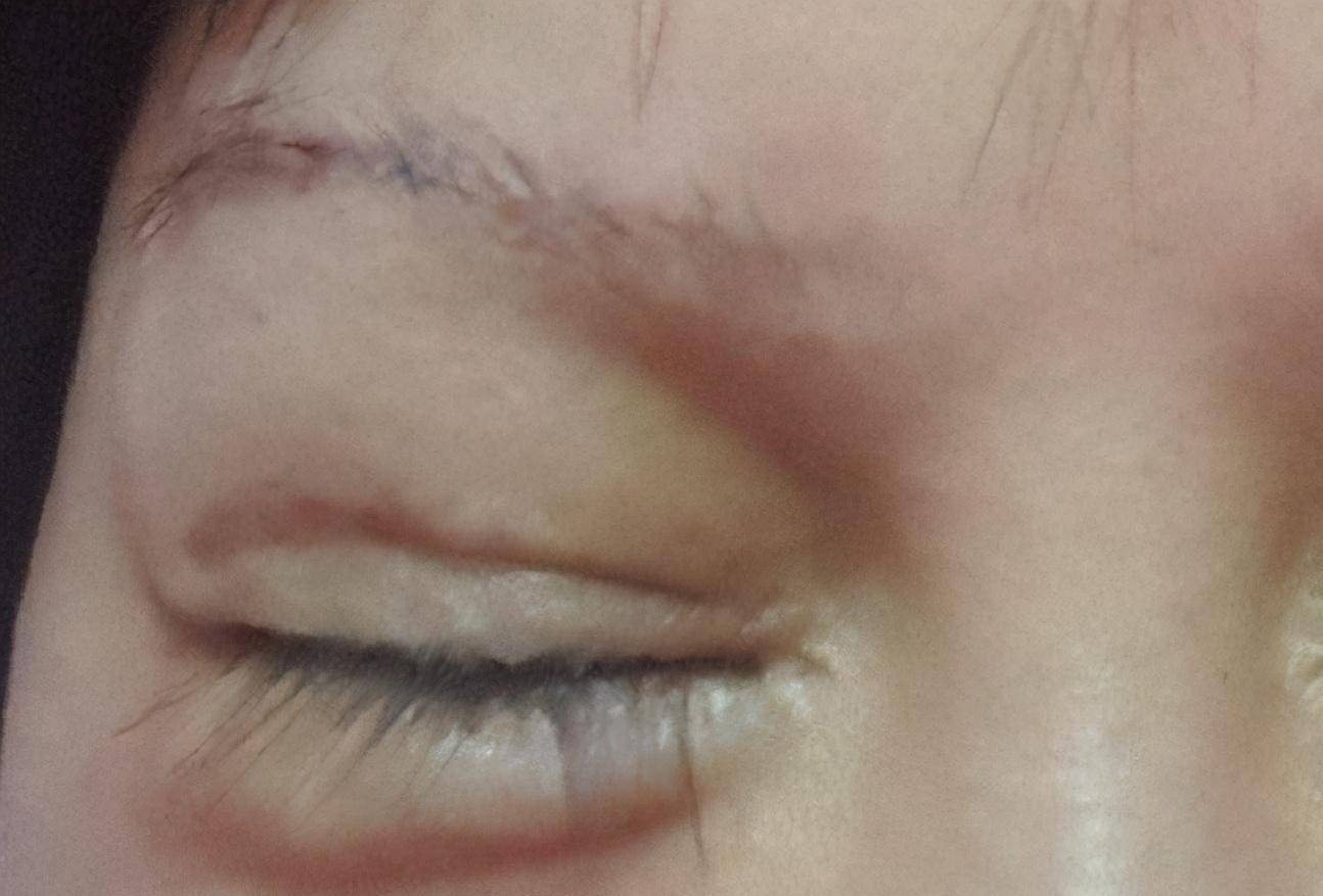 原创16岁开始整容花400多万整容200多次的红粉宝宝今如何