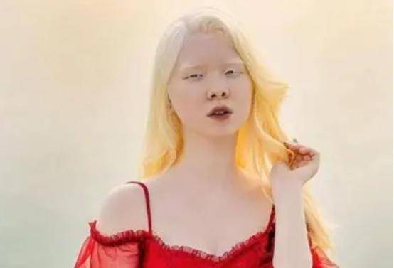 原创一对没有颜色的姐妹遭受14年歧视拍完一组照片后惊艳世界