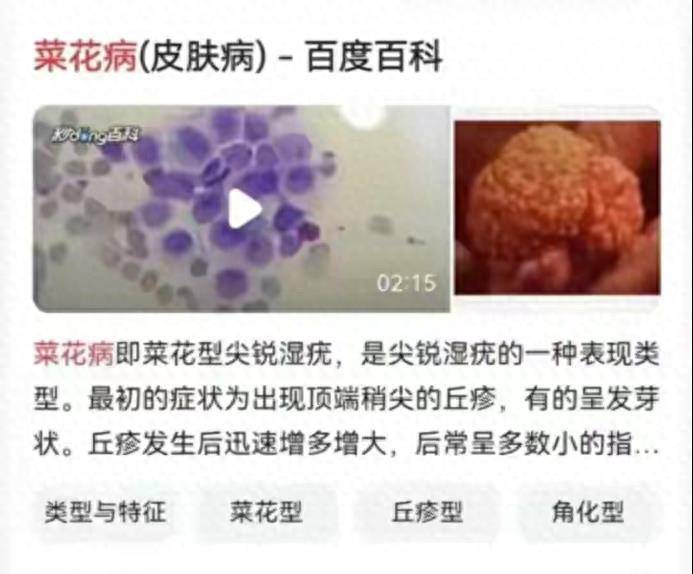 原创真吓人女生千万不要在网上买内裤容易被传染