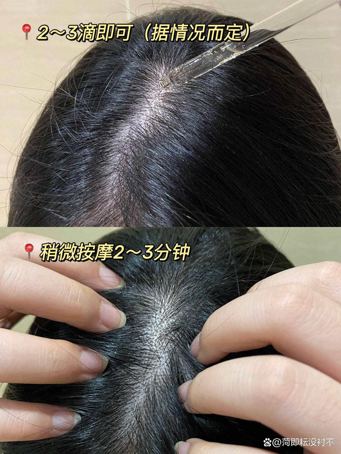 测评排名第一的防脱生发产品这几款让你轻松拥有秀发