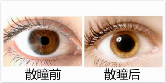 孩子才4岁,能做散瞳验光吗?_眼睛_视力_医生