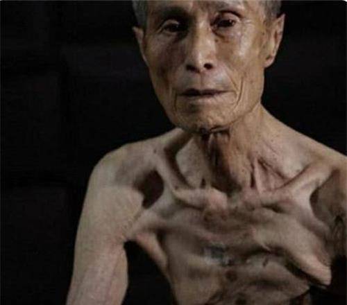 爆炸幸存者,面对采访时哭诉:美国为何要制造这种"怪物"_日本_原子弹
