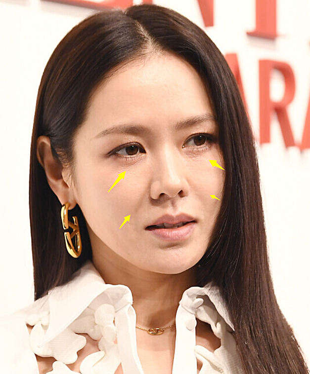 42岁孙艺珍活动生图来了!皱纹明显衰老很多,膝盖伤痕明显!