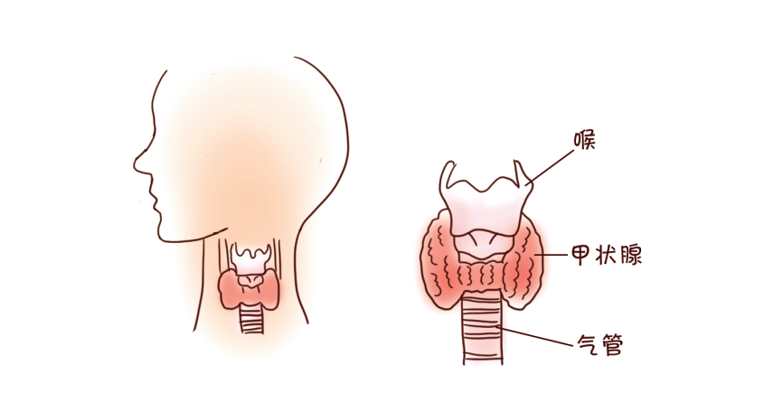 西安甲康医院魏帮革医生讲解甲状腺问题到底该补碘还是限碘
