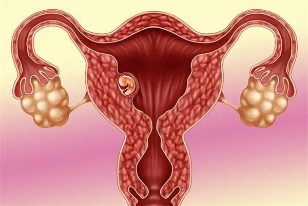 胚胎移植着床还需要保胎吗通常情况下,胚胎移植后的第10