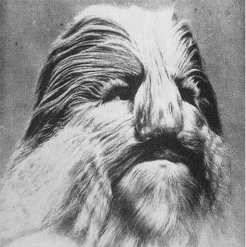 原创欧洲真实的半狮半人加入马戏团后走红成百万富翁结局如何