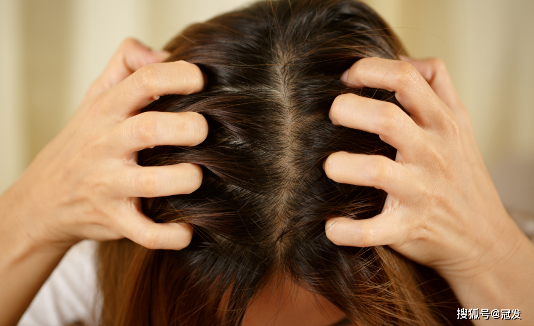 春季头皮敏感冠发专业养护方案来帮忙