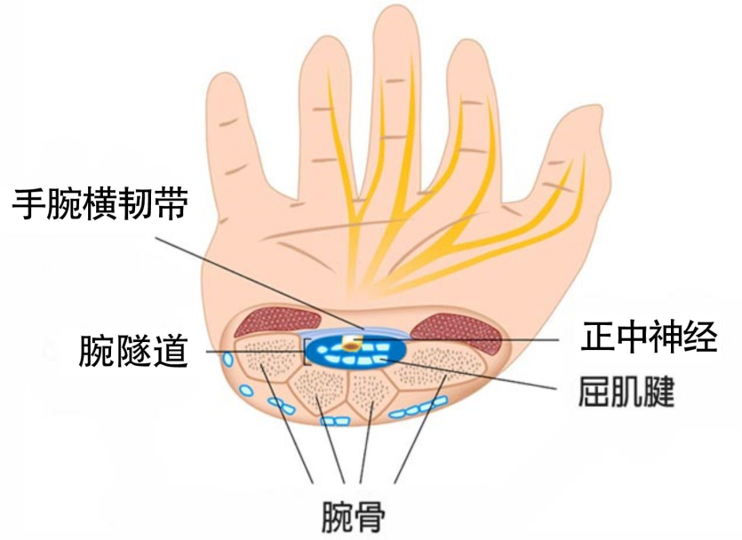 (腕管结构)当手和手腕向上弯曲时,腕管内的空间会变小