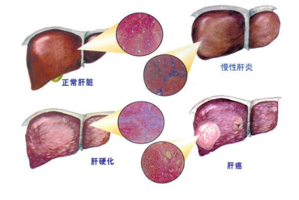 渝偲医药科普文章:dlin-mc3-dma在lnpsirna系统中的应用_基因_肝脏