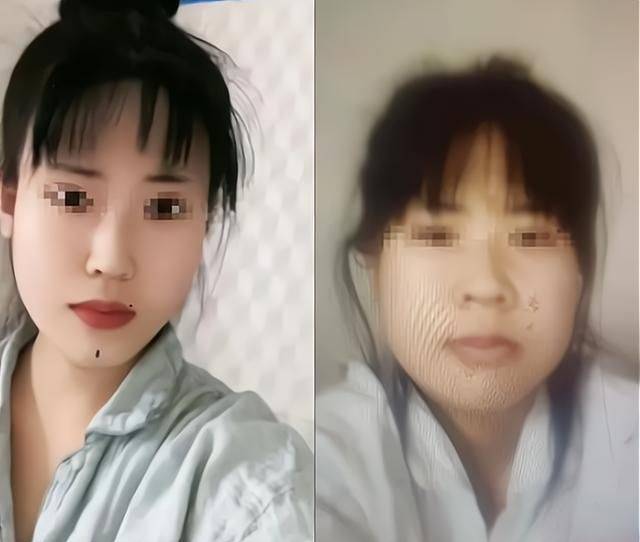 医美机构称与其无因果关系_手术_进行_社会
