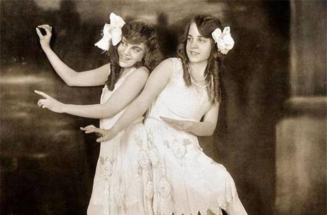 英国臀部连体姐妹各有一名丈夫姐姐死后妹妹与遗体共存2天去世