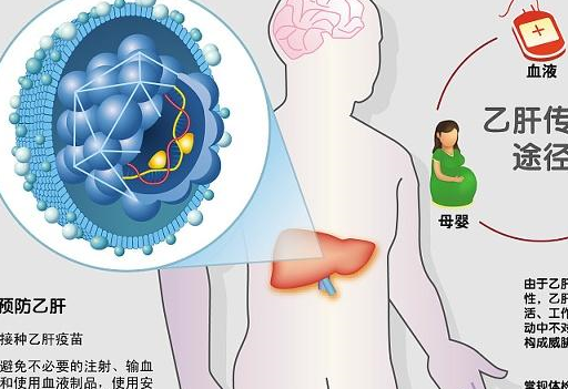 原创乙肝病毒携带者和得乙肝有什么不同会不会传染给别人