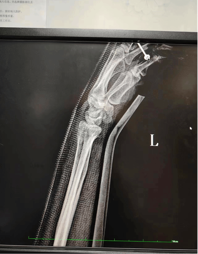 西安未央这家诊所"中医祖传正骨"疗效显著_田少波