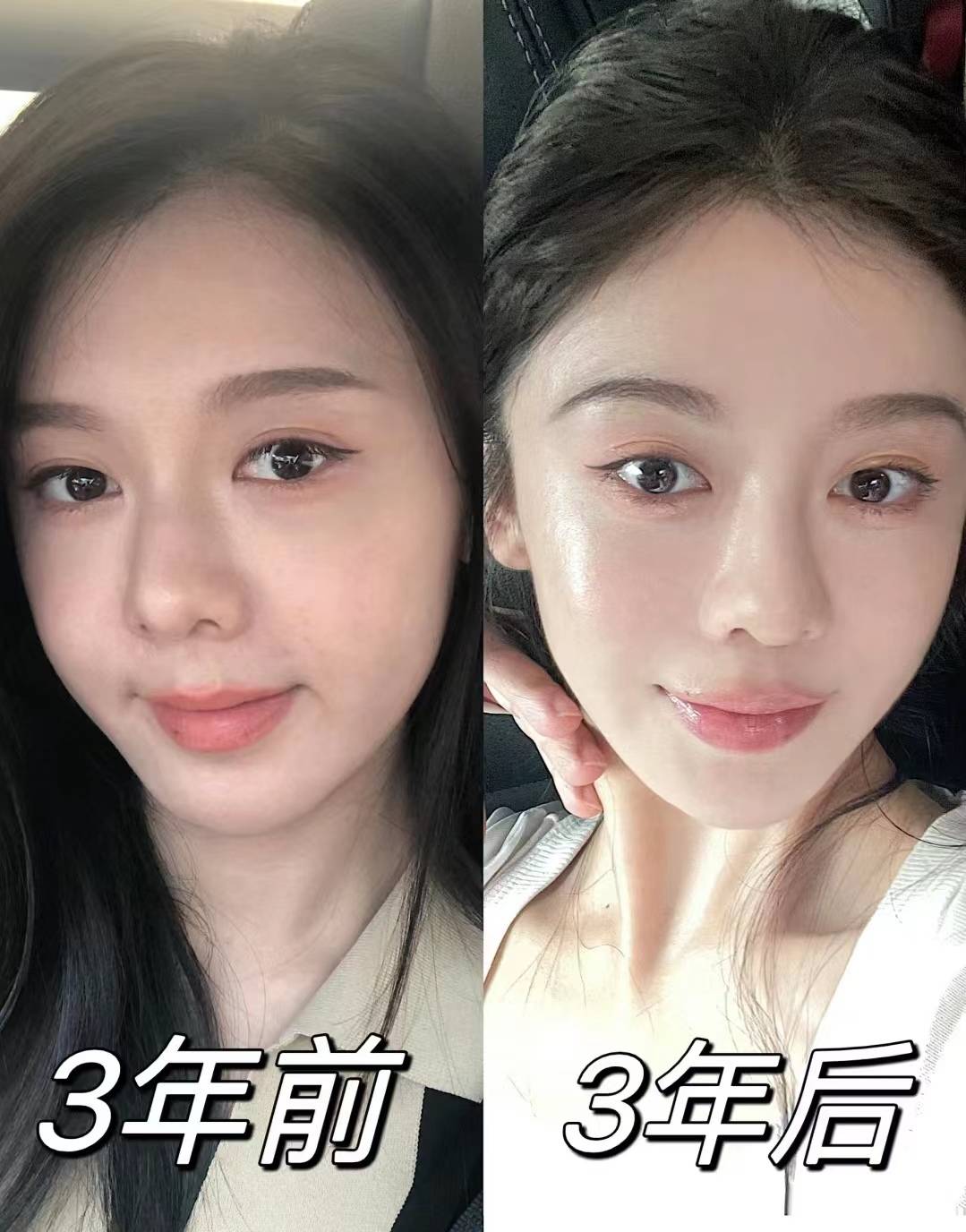 为什么不爱洗脸的人,皮肤反而更好?说了怕你不信,直接看对比图