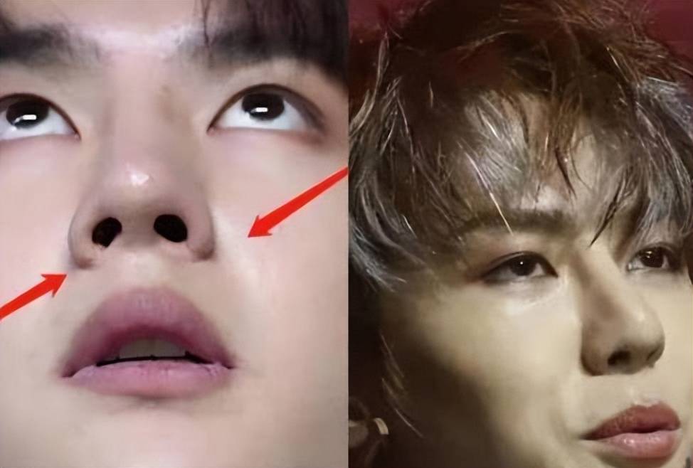 原创王一博新剧状态堪忧整容后遗症明显年代戏镜头里全暴露