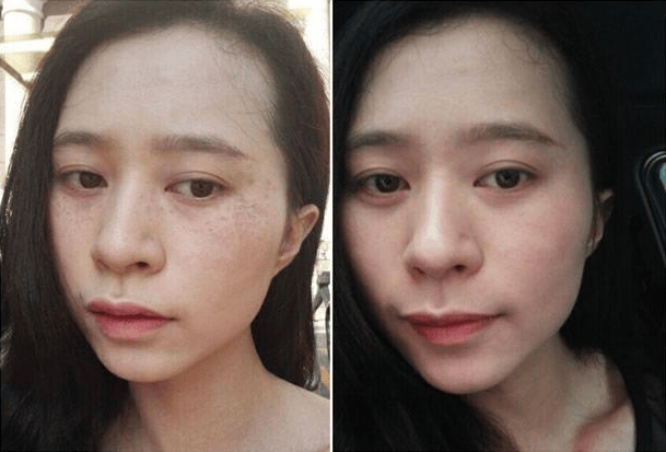 淡斑精华液排行榜10强,榜前top3,值得推荐收藏_产品_祛斑_肌肤