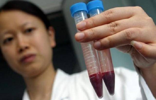 18年福建一男子去做亲子鉴定发现自家双胞胎有一个不是自己的