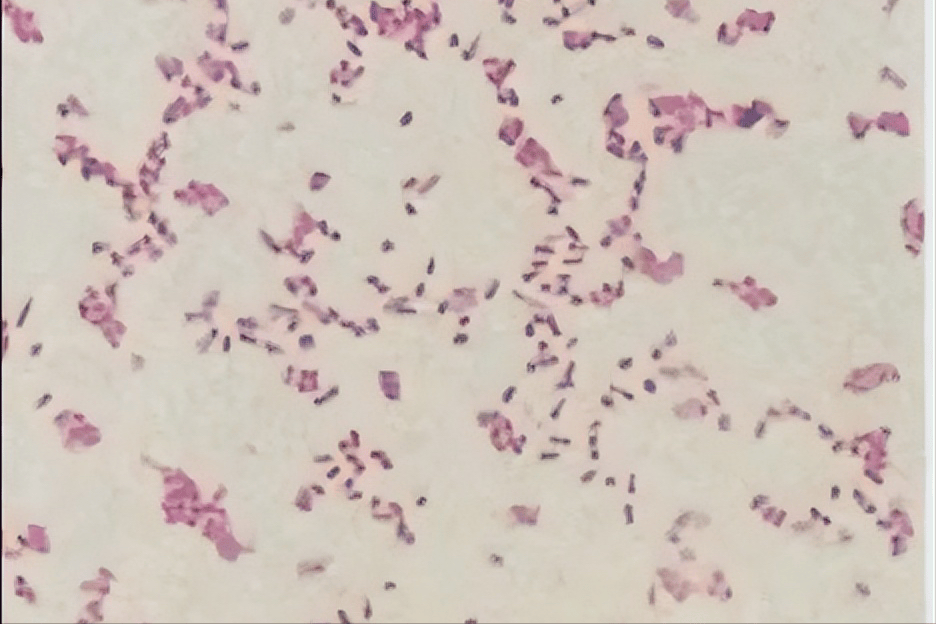 康禾_病原菌_笔者