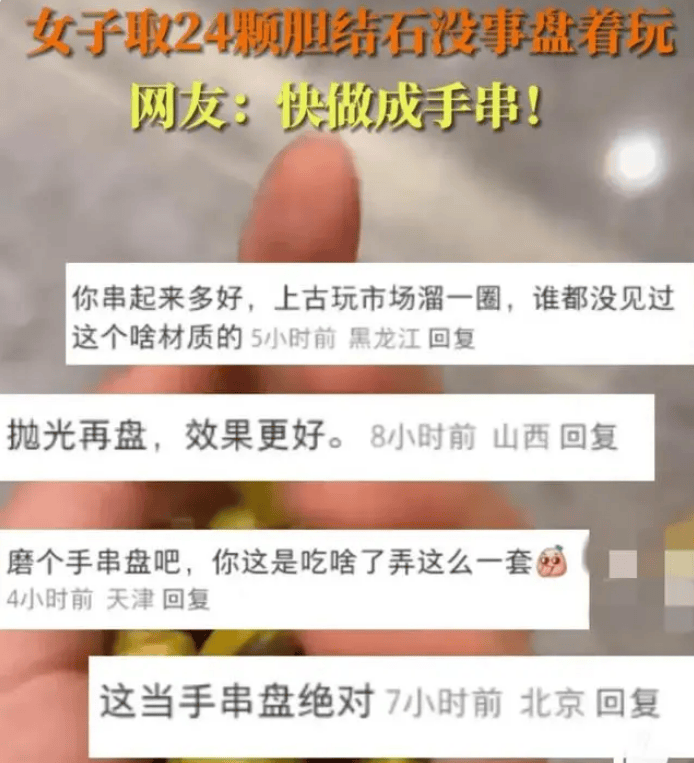 女生取24颗胆结石没事盘着玩,网友戏称：结丹期高手啊！