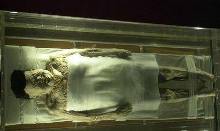 历史上长沙马王堆女尸辛追夫人的死因到底是什么呢?