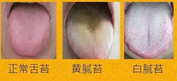 疳积舌头图片