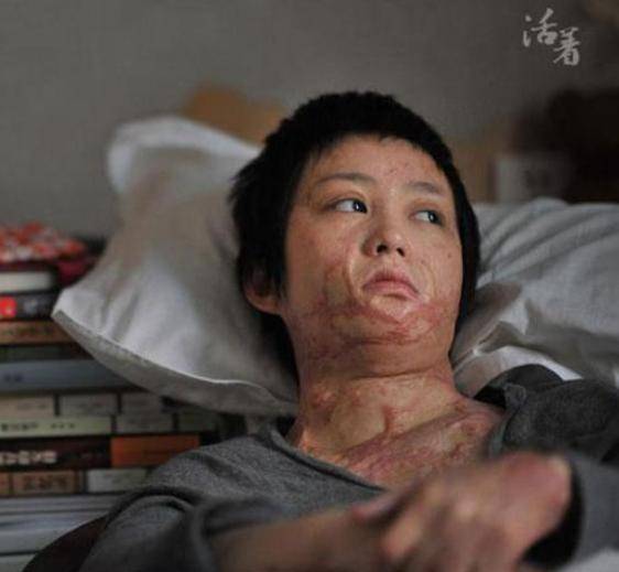 原创16岁的周岩拒绝官二代追求竟惨遭大火毁容现在过得如何