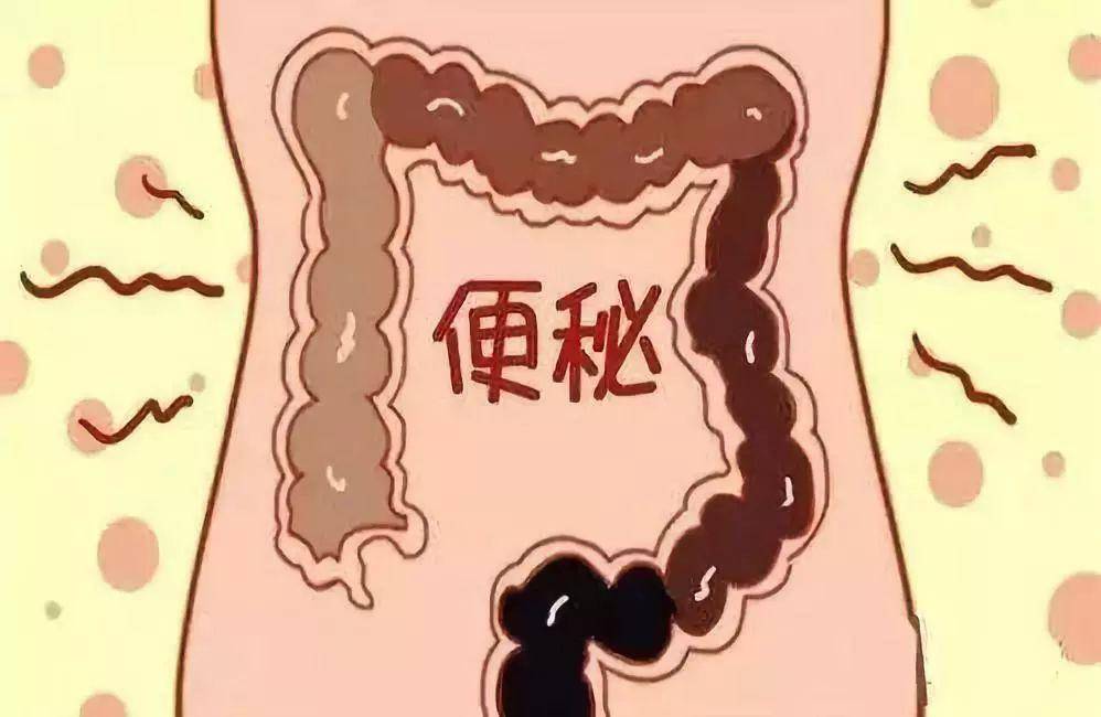 原创肚子胀胀排便不畅教你5个方法缓解便秘让你畅通无阻