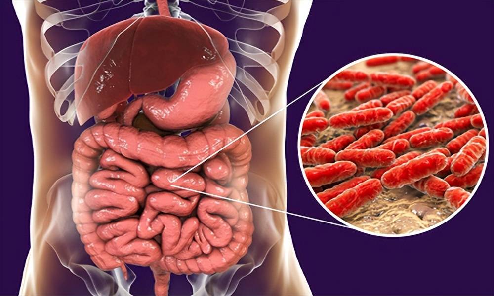 甲状腺功能减退与小肠细菌过度生长之间的联系