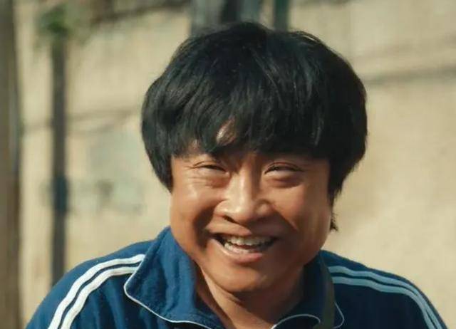 面部肌肉黝黑松垮不说,眼袋也太明显了,笑起来眼角的鱼尾纹更显年龄感