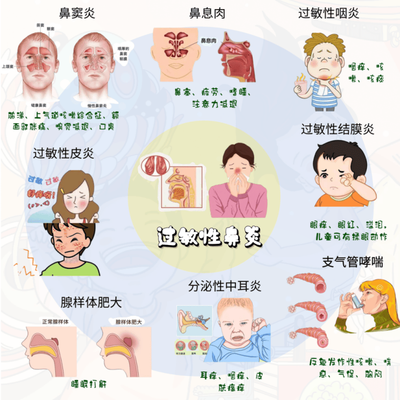 济南中医儿科杨晓:孩子过敏性鼻炎是怎么回事?如何推拿及预防