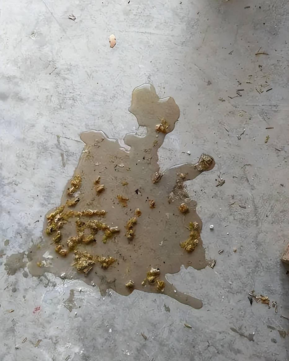 肠道_问题_霉菌