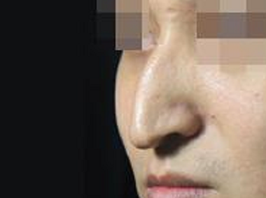 冷漠心狠这几种面相特征的男人分手后无情无义不可深交