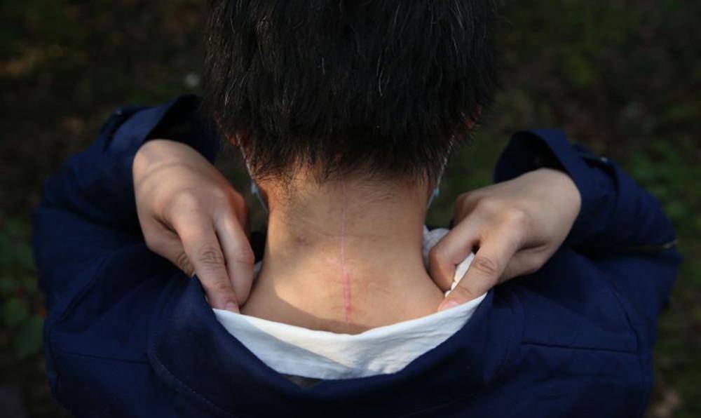 原创轰动一时的八达岭老虎咬人案幸存者索赔百万失败因毁容无工作