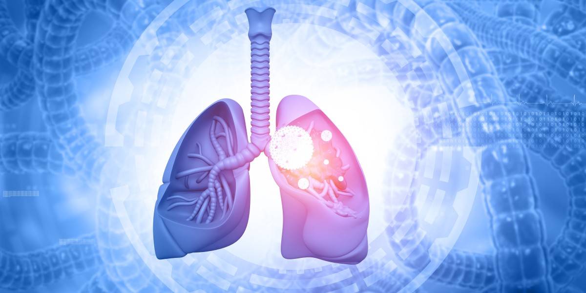 补肺养肺吃什么植物最好助力清新呼吸