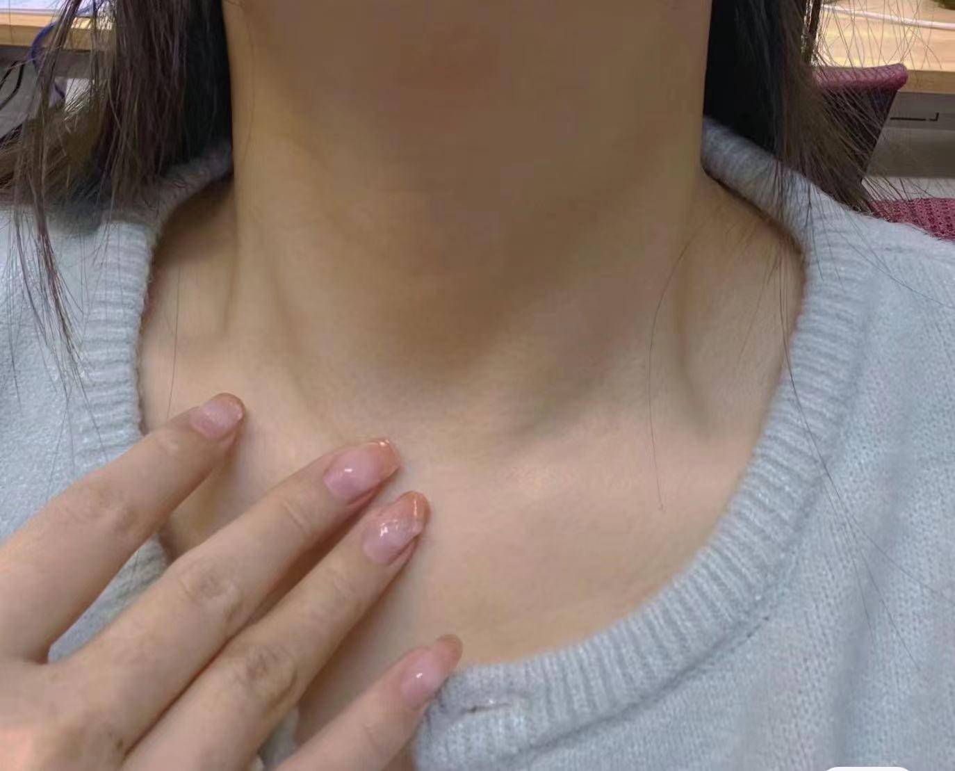 摆脱甲亢并不难!学会这3招,在家也能治好它!_脖子_方法_甲状腺