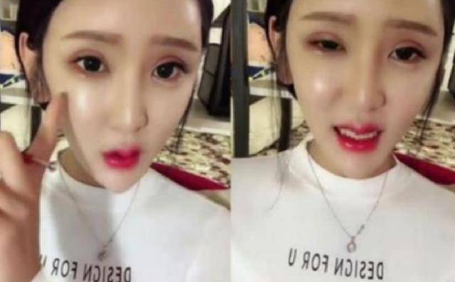 原创整容狂人红粉宝宝花400万换脸200次今坐轮椅悔不当初