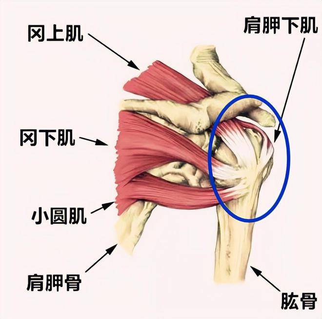 肩周炎哪里痛图片解析图片