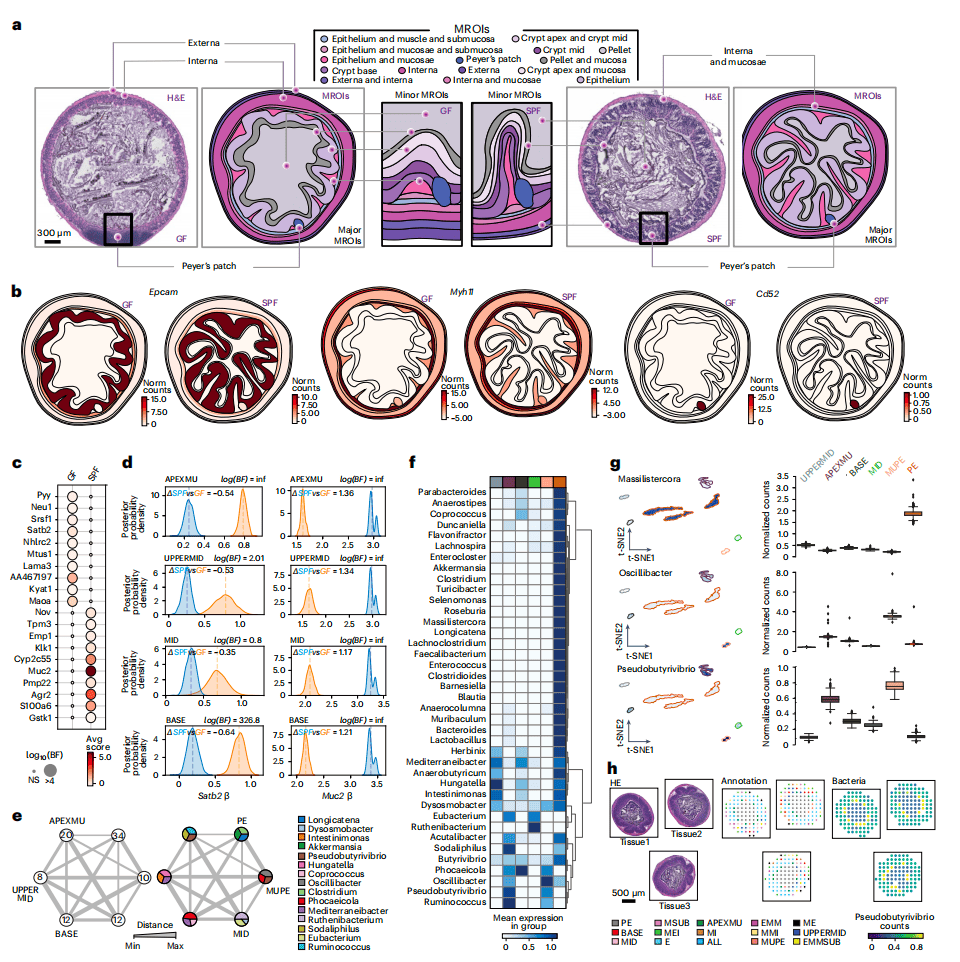 nbt新技术震撼来袭一张切片揭示空间宿主微生物组互作
