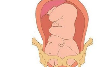 孕妇待产宫缩时腰好痛的原因孕妇待产时腰痛怎么办